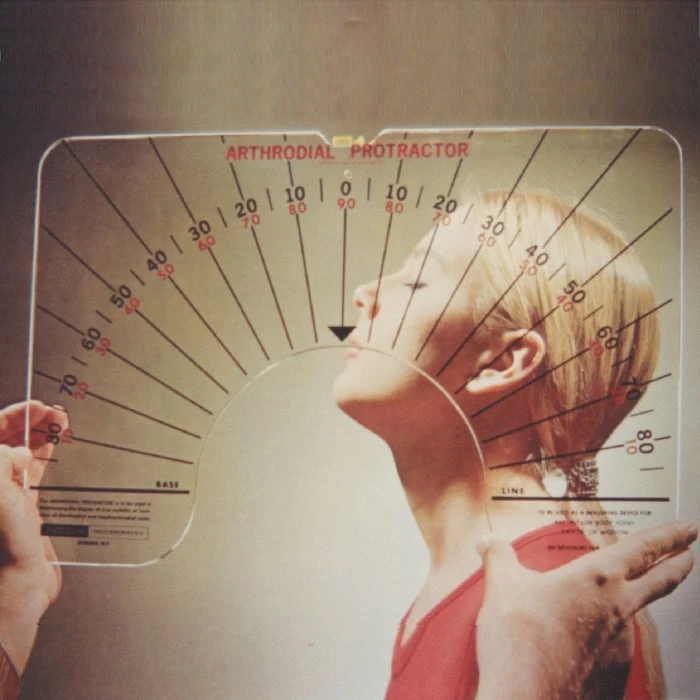 Arthrodial Goniometer 3 Arthrodial Goniometer